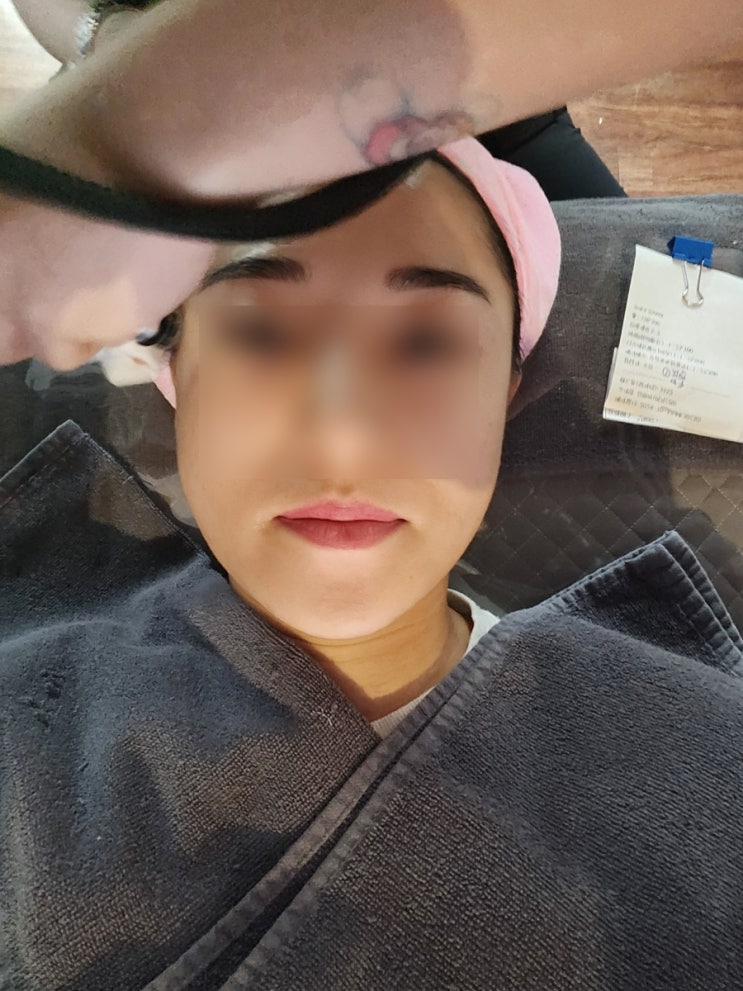  아쿠아필, 아기레이저 받은 생생후기 내돈내산
