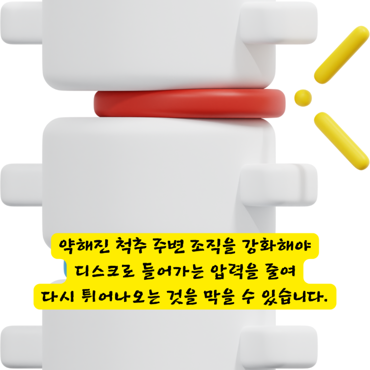  서면정형외과, 목디스크 주사도 시술도 소용없다면 '이것'을 확인하세요