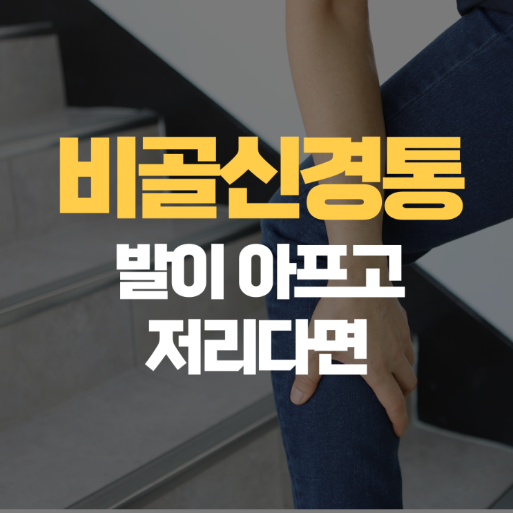 비골신경통 발에 감각이 떨어지고 아프다면? 비골신경통 발에 감각이 떨어지고 아프다면?