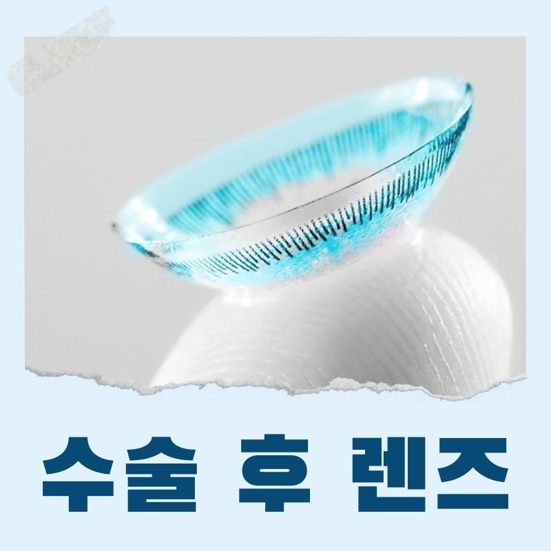 라섹 라식 후 컬러렌즈 껴도 될까?