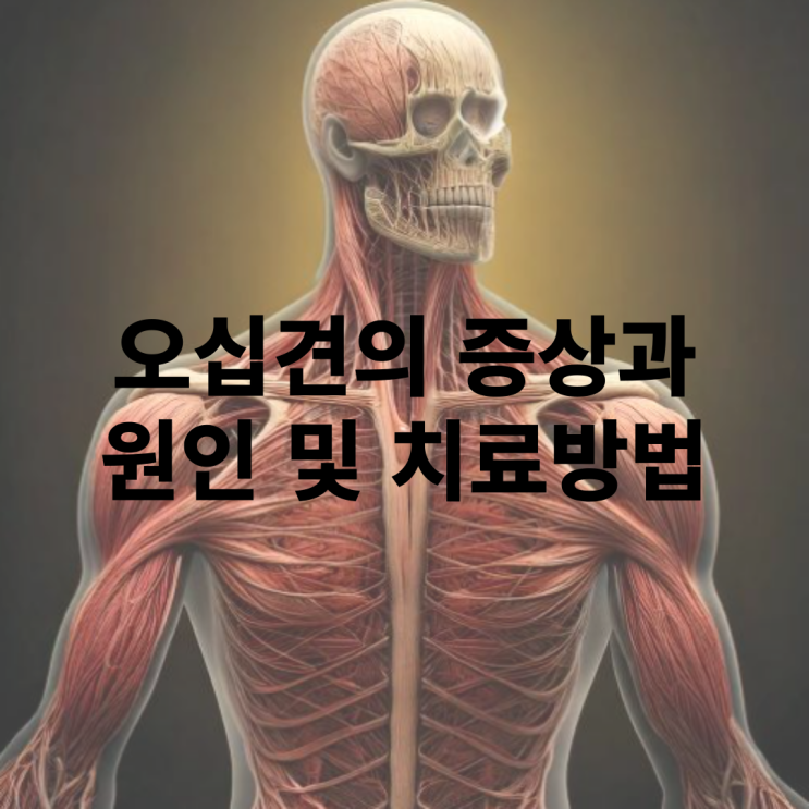  어깨 오십견 증상과 치료 방법은 무엇인가?