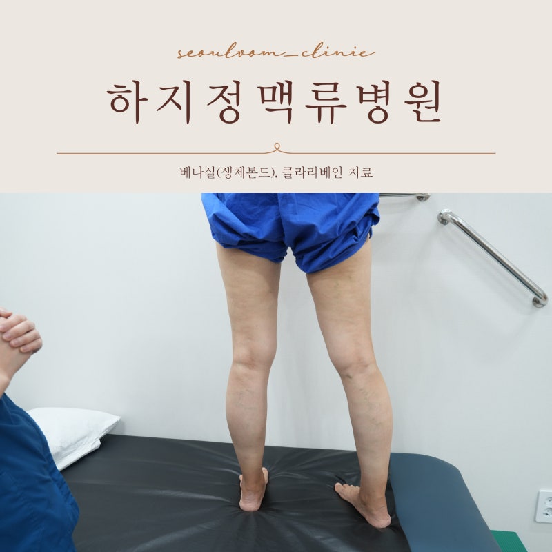 청주하지정맥류병원 이런 치료 방법으로 부담 없이