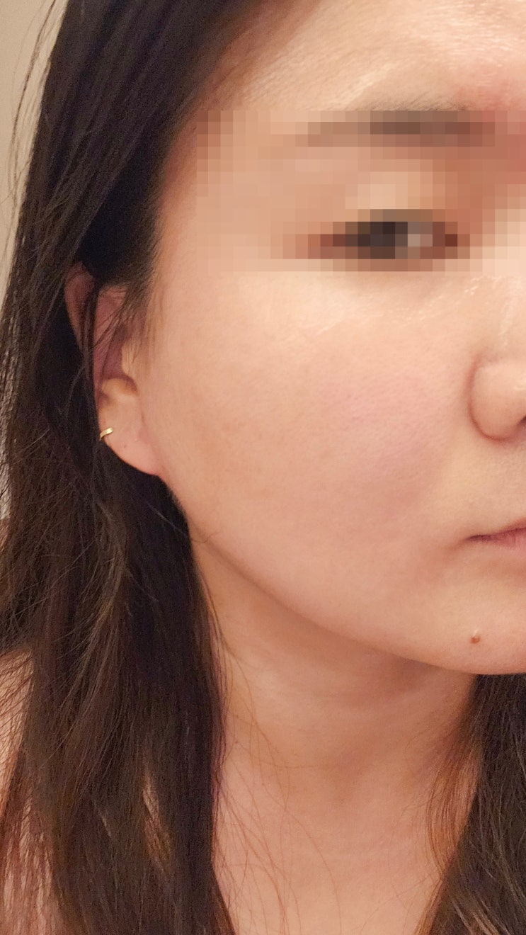  청주에서 얼굴경락 제일 잘하는 곳 아름하다 다시 재방문한 후기