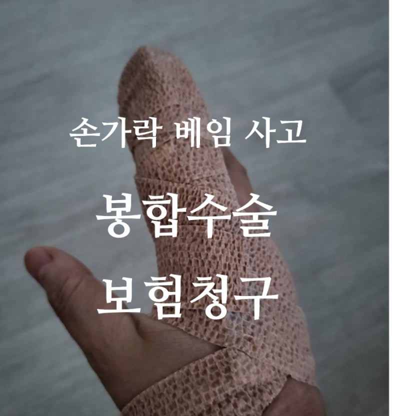 손가락꿰맨수술 봉합수술 보험청구 상해수술비 실손보험청구하기