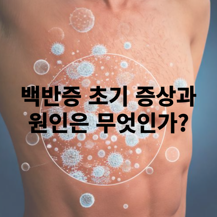  백반증 초기 증상 및 원인은 무엇일까?