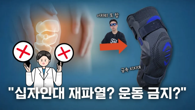 십자인대 재파열이 운동 그만두지 않아도 됩니다. 부상 복귀 1옵션 십자인대보호대 게뉴 리....