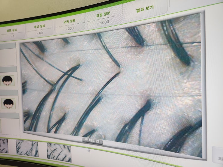  세종시탈모 나성동 이안두피탈모 두피관리 추천