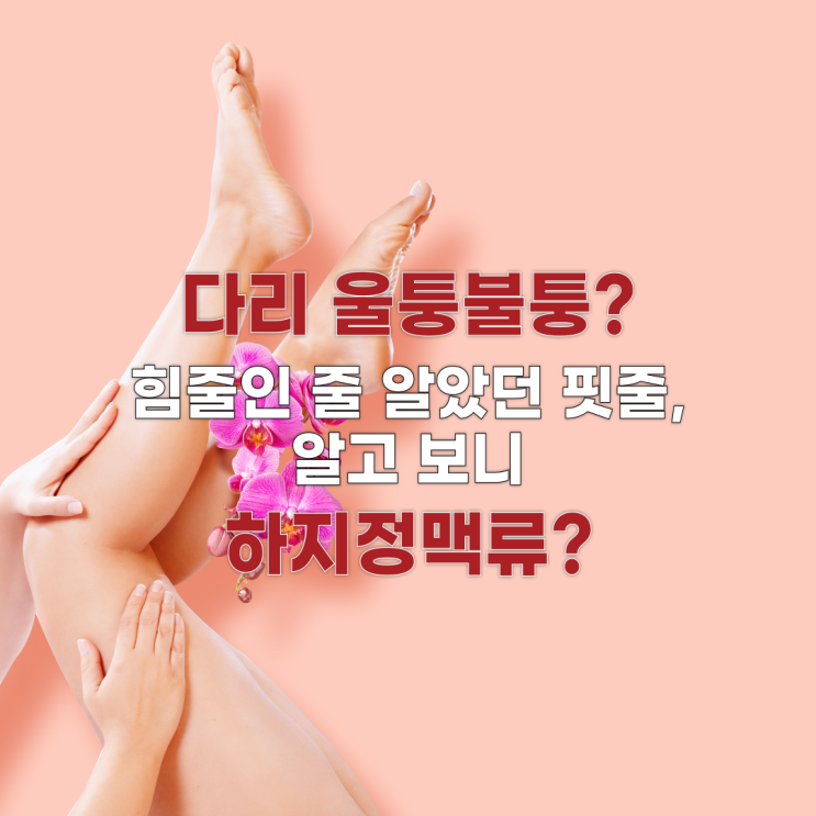  다리 울퉁불퉁? 하지정맥류 원인과 증상, 꼭 알아야 할 예방법과 치료법!