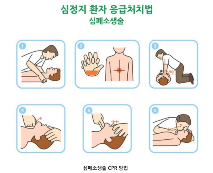  급성 심정지 응급처치 CPR