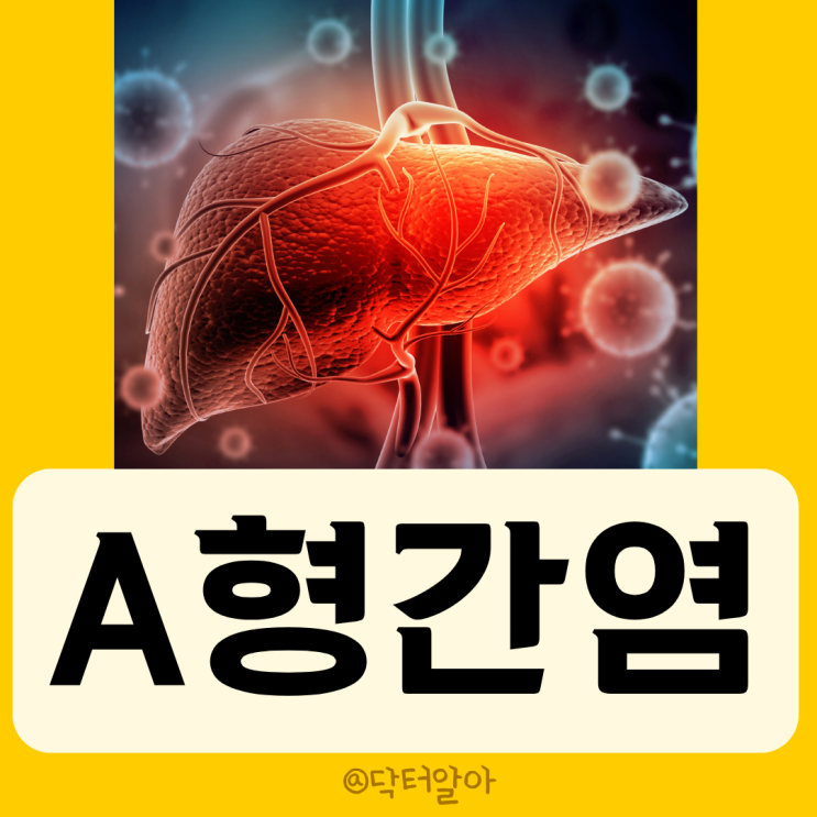  A형 간염(Hepatitis A)의 정의, 증상, 진단, 치료 및 예방