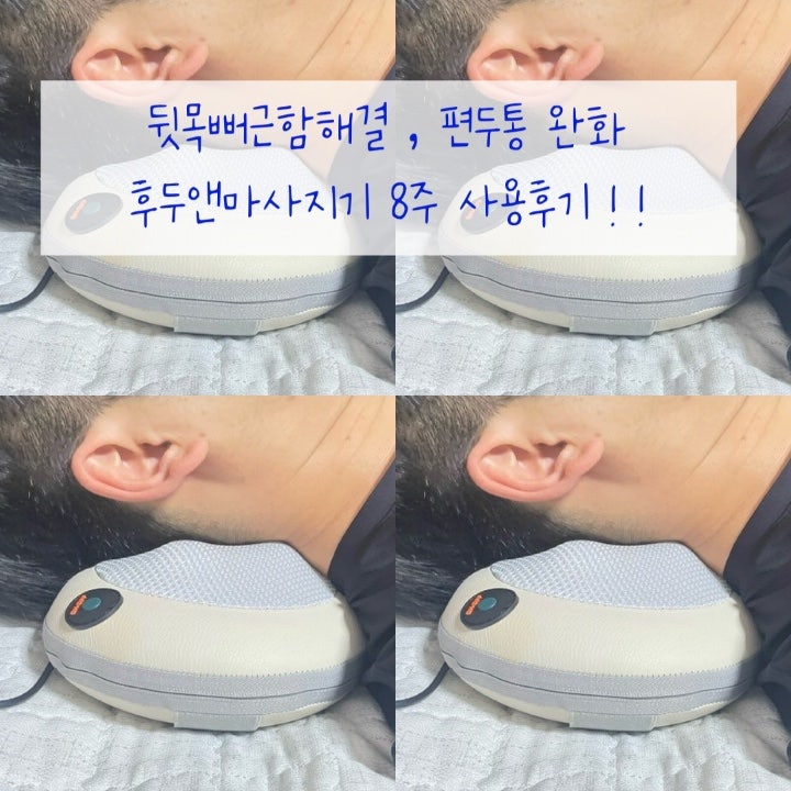 하루 10분 뒷목뻐근함 해결 일자목 경추성두통 후두앤마사지기 솔직후기
