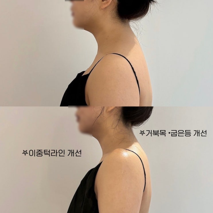  서면다이어트 서면체형관리 서면독소관리 내돈내산 추천 : 브로우아포유