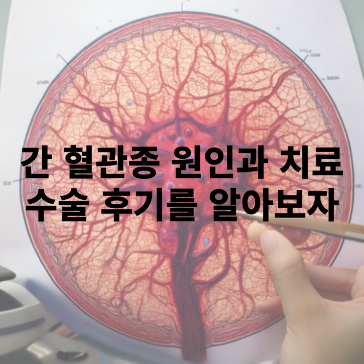  간 혈관종 원인과 치료, 수술 후기를 알아보자
