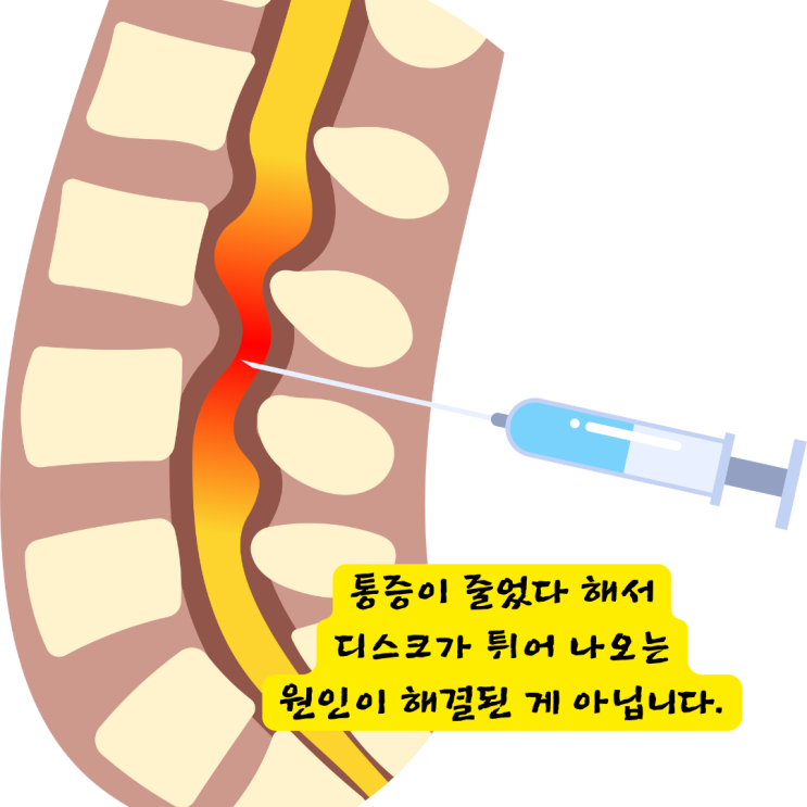  센텀한의원, 허리디스크 수술 없이 회복하는 치료 원칙 1가지.