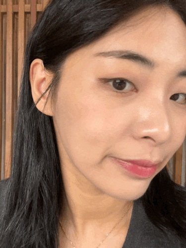  용산피부과 스킨부스터 PDRN 콜라스터 3회차 후기