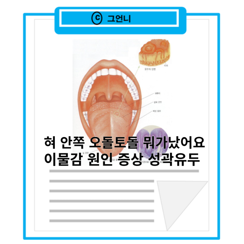 혀 안쪽 오돌토돌 뭐가났어요 이물감 원인 증상 성곽유두