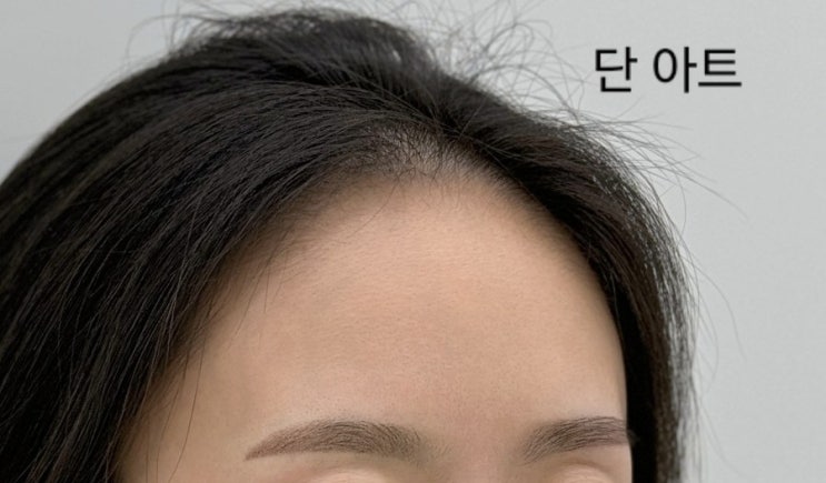  신촌눈썹문신ㅣ단 아트ㅣ 이대 자연눈썹ㅣ통증 없는 파우더 브로우 기법