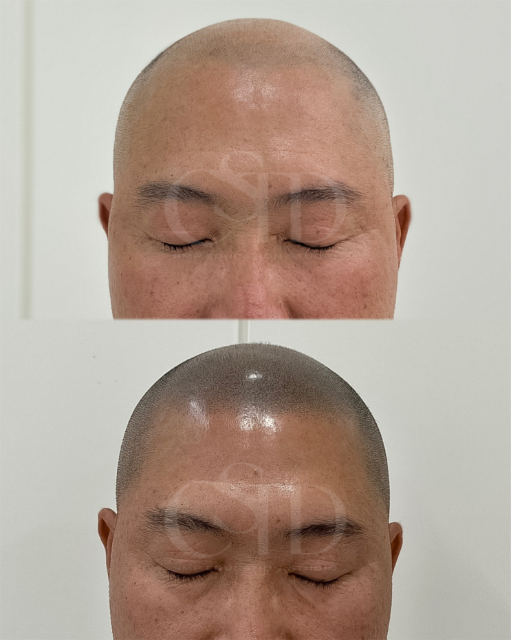  여수두피문신수강 기술력을 체크하세요