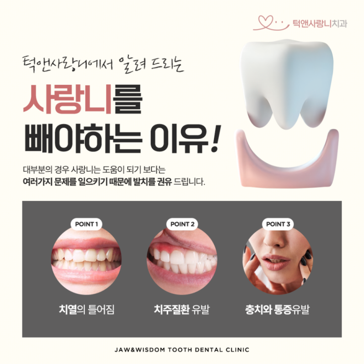  천안사랑니 당일발치 가능한 치과