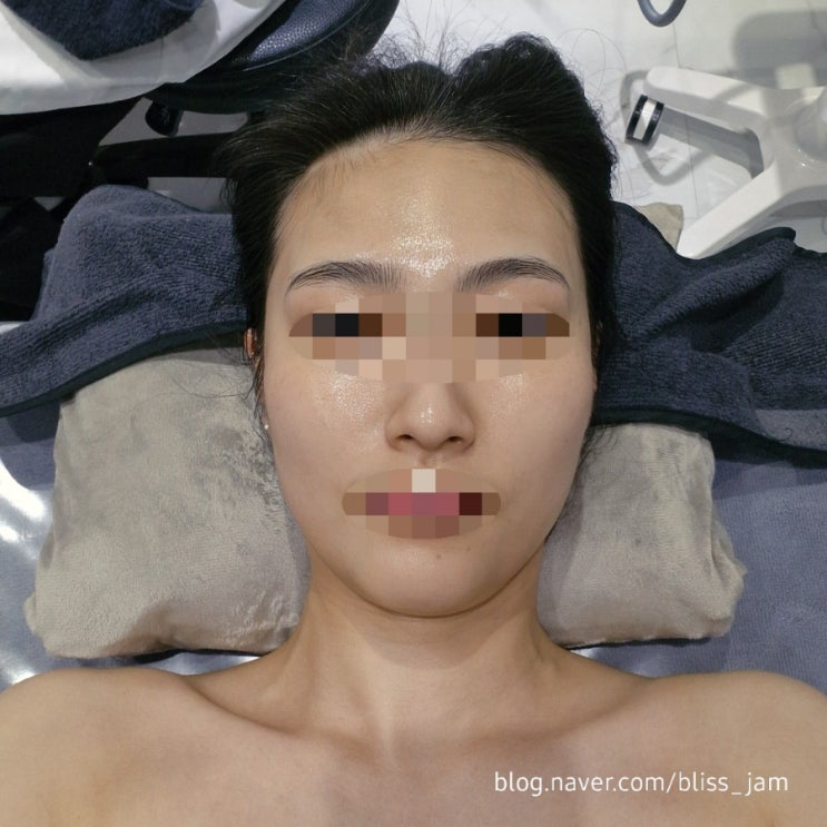  속건조 불당동 피부 비타민관리 뷰티에이