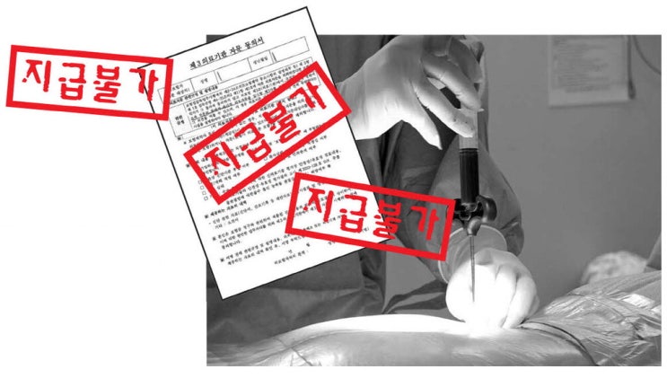 "실손보험금 못드립니다"… 신의료기술 발목잡는 의료자문 "실손보험금 못드립니다"… 신의료기술 발목잡는 의료자문