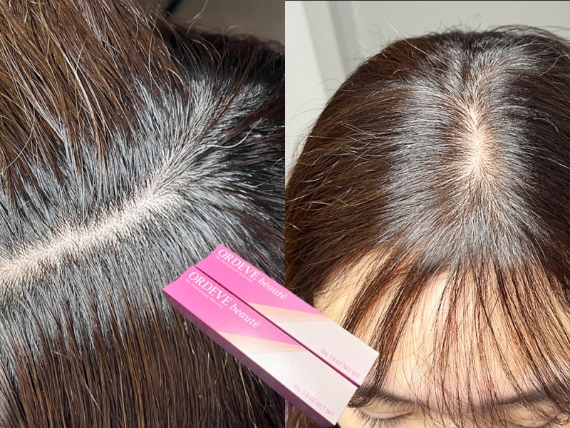 새치 염색약 추천! 밀본 보떼 셀프 염색 후기