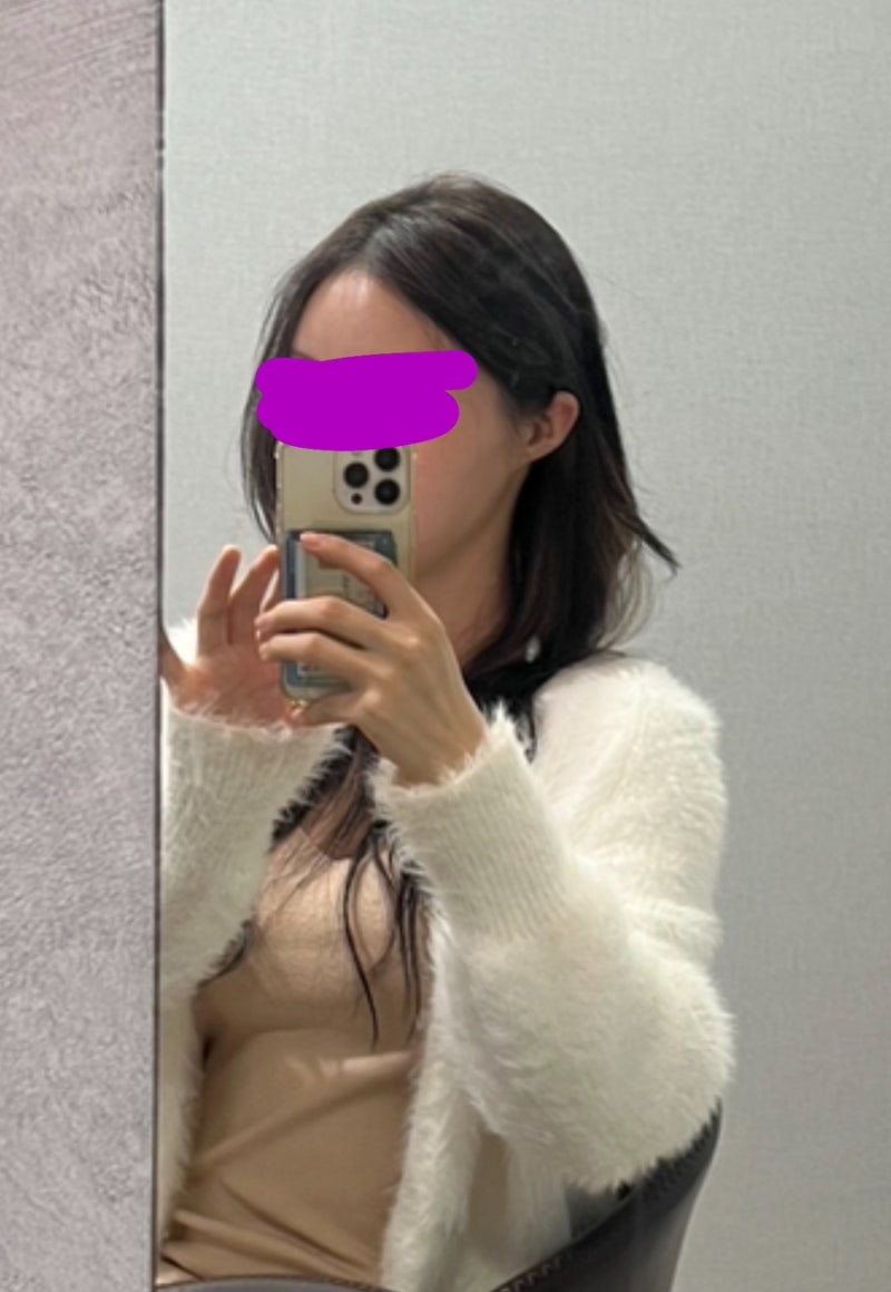 내돈내산 귀수술 귀필러 다해봤다!!! 누운귀 칼귀 작은귀 후기 비용 금액