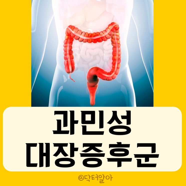  과민성대장증후군(IBS) 의 정의, 원인, 증상, 진단, 분류 및 치료