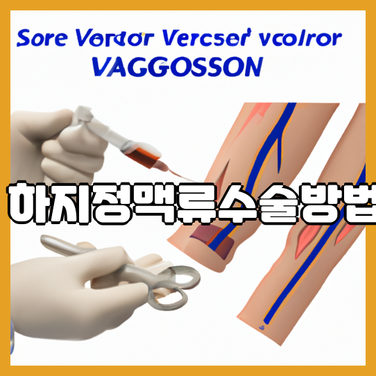 하지정맥류수술방법