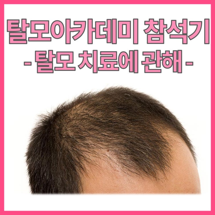  어느샌가 머리가 가늘어지고 숱이 줄어든다면? 탈모 아카데미 다녀왔어요!