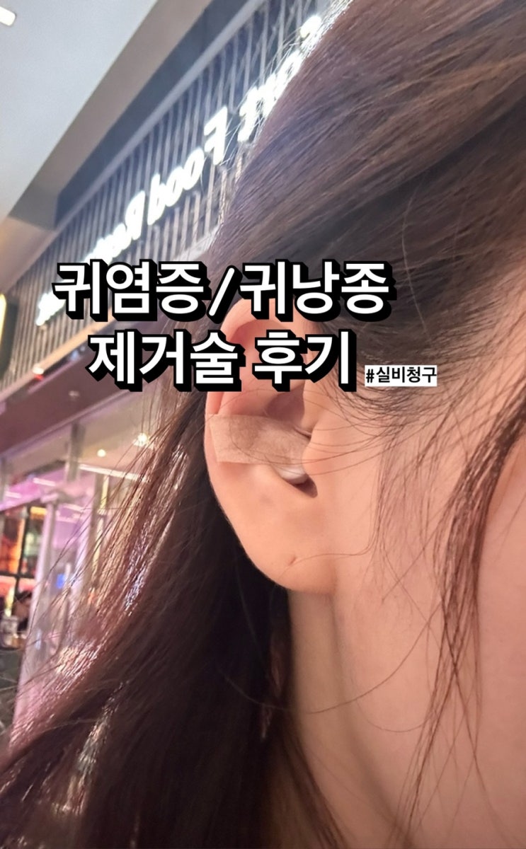  귀염증 이갑개 염증 통증, 낭종제거술 실비청구 (feat. 코나이비인후과의원)