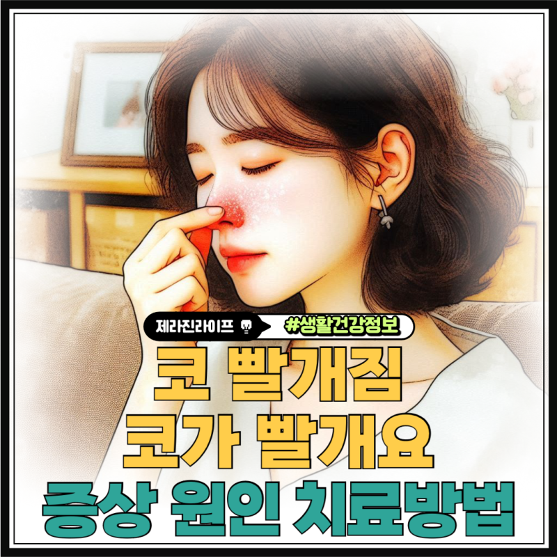 코 빨개짐 코가 빨개요 증상 원인 치료방법