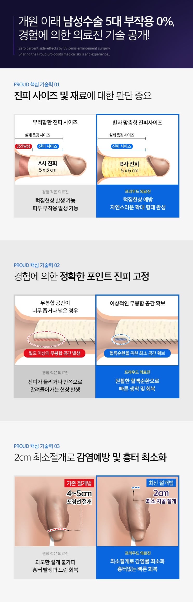  대한민국 남성확대수술 1위, 5S복합수술 이벤트 진행중