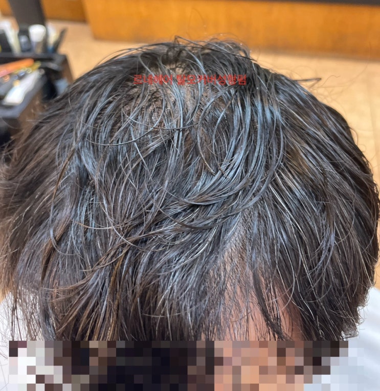  엠자탈모정수리탈모부분탈모가는머리볼륨없는머리모두주목 헤어두상성형탈모커버성형펌합니다. / 개금사상덕천덕포화명양산울산거제명지김해범일동래명륜금정장전사직연제망미수영광안해운대용호