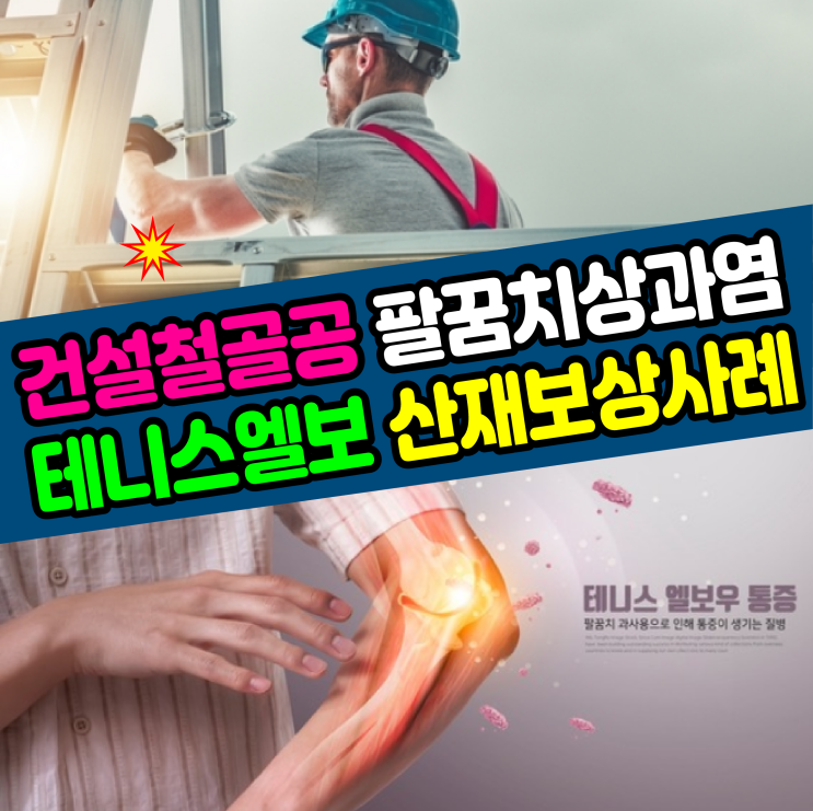  [부산/김해/양산 노무사] 건설 철골공 팔꿈치 상과염(테니스엘보) 산재보상 사례