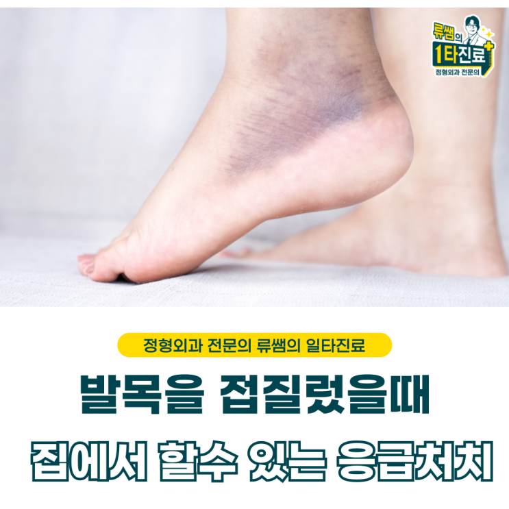  발목을 접질렀을때 집에서 할 수 있는 응급 처치 (의사 작성)