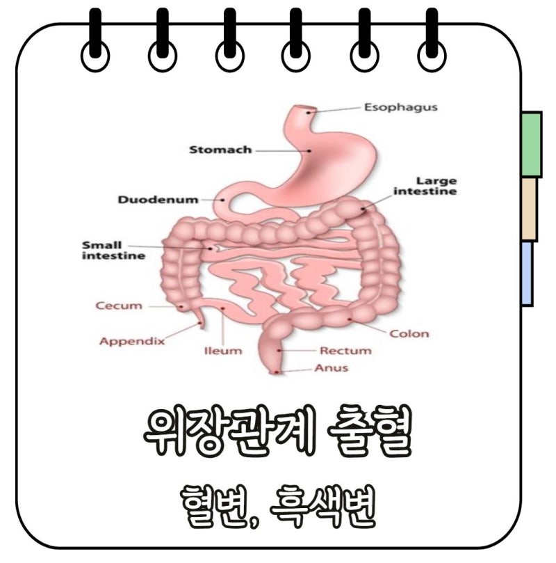 의학용어 GI Bleeding melena 흑색변 hematochezia 혈변 원인 차이점 증상 치료