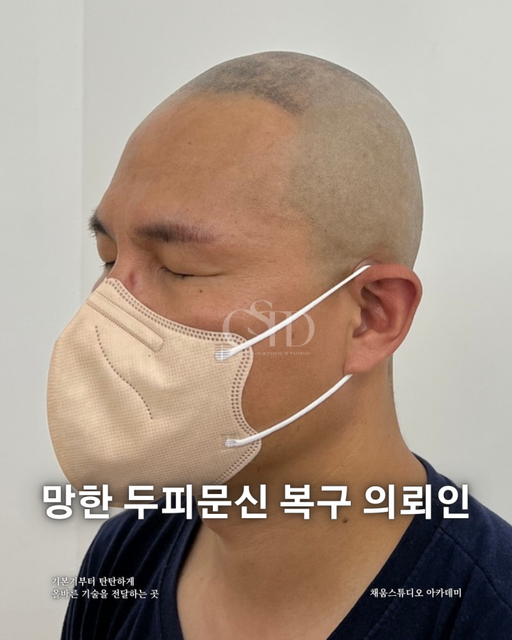  광주 두피문신 제거 방법과 효과