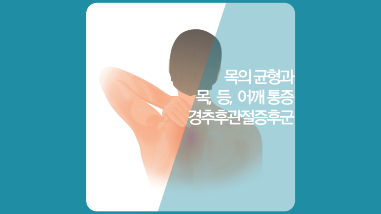  인천목디스크(일자목, 거북목)병원-목뒤통증이 등, 어깨 통증의 원인(경추후관절증후군)