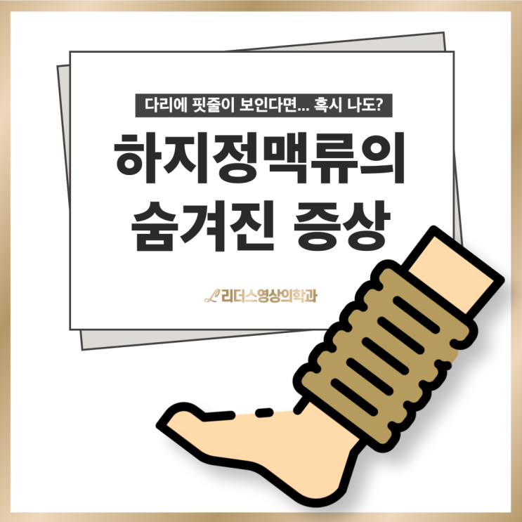  인천 하지정맥류 수술로 치료해야할까? (하지정맥류의 숨겨진 증상 알아보기)