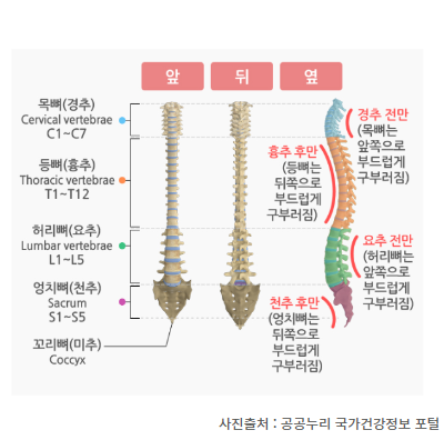 요추 경추 추간판탈출증 디스크 원인 증상 진단 Lasegue 라세그 검사 : 네이버 블로그