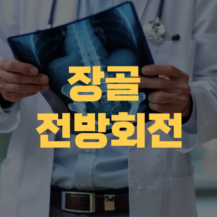장골의 전방회전에 따른 연쇄작용 장골의 전방회전에 따른 연쇄작용