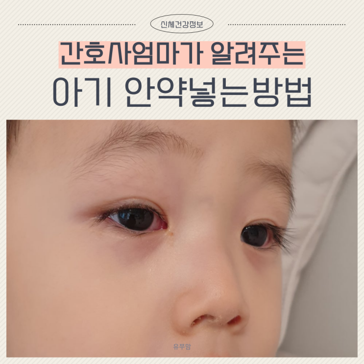  아기 안약넣기 안약넣는방법 꿀팁