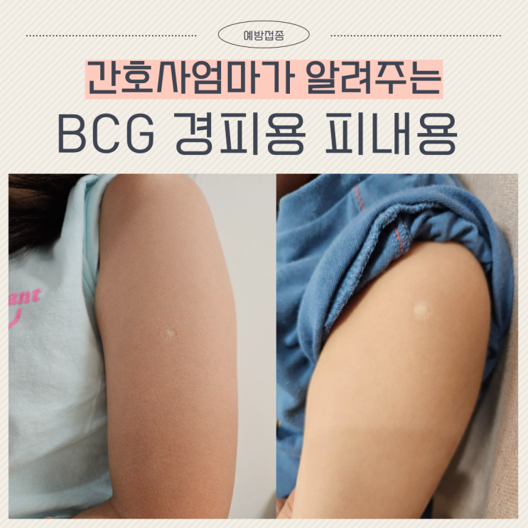  신생아 BCG 접종시기 경피용 피내용 선택 이유