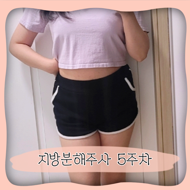 복부 지방분해주사 비교 후기 ㅣ 무제한 바디지방분해주사 5회차