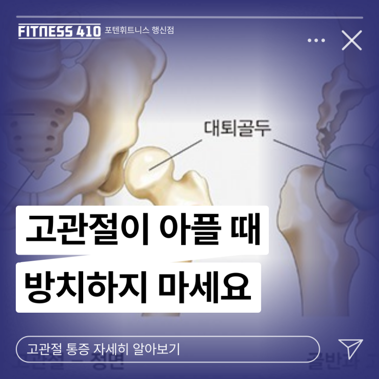  고관절 통증 그냥 넘어가면 안 됩니다 행신동헬스장 행신피티 행신PT 행신역헬스 화정헬스