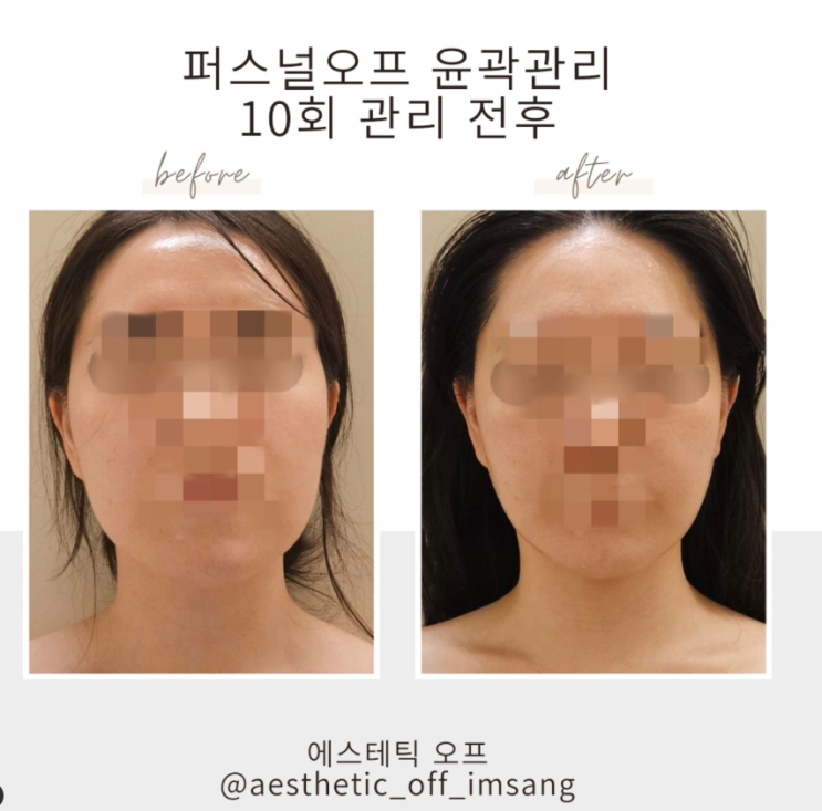  광주신부관리, 10회 관리로 달라지게 된 비결