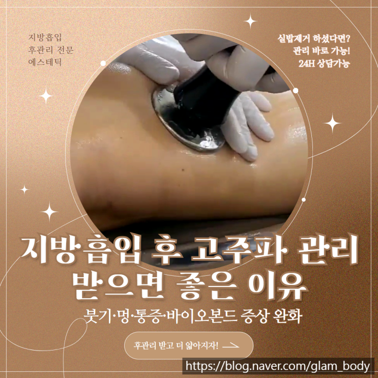  지방흡입 사후관리 고주파가 효과적인 이유
