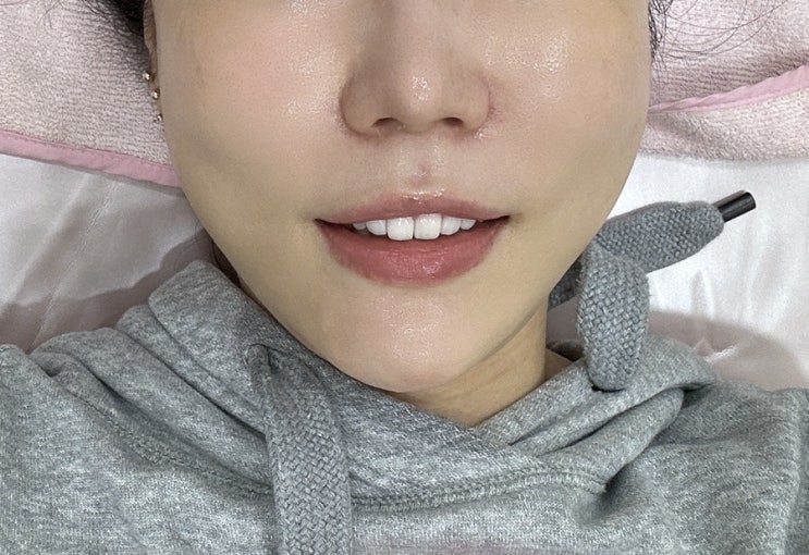  환절기 피부관리방법 모공 디톡스 관리 후기 by 수지피부관리 올가드림뷰티 수지구청점