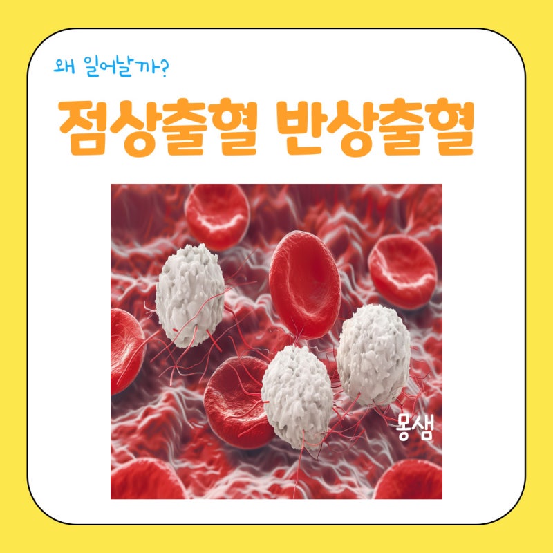 점상출혈 반상출혈 원인과 치료는? : 네이버 블로그